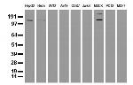 ERBB2 Antibody in Western Blot (WB)