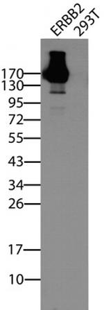 ERBB2 Antibody in Western Blot (WB)
