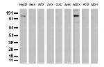 ERBB2 Antibody in Western Blot (WB)