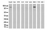 ERBB2 Antibody in Western Blot (WB)