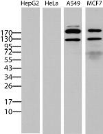 ERBB2 Antibody in Western Blot (WB)