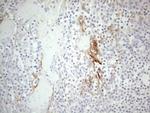 ERBB3 Antibody in Immunohistochemistry (Paraffin) (IHC (P))