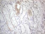 ERBB3 Antibody in Immunohistochemistry (Paraffin) (IHC (P))