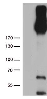 ERBB3 Antibody in Western Blot (WB)