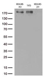 ERBB3 Antibody in Western Blot (WB)