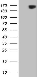 ERBB3 Antibody in Western Blot (WB)