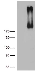 ERBB3 Antibody in Western Blot (WB)