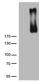 ERBB3 Antibody in Western Blot (WB)