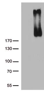 ERBB3 Antibody in Western Blot (WB)