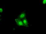 ERCC1 Monoclonal Antibody (OTI1C6), TrueMAB™