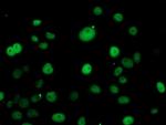 ERCC1 Antibody in Immunocytochemistry (ICC/IF)