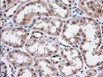 ERCC1 Antibody in Immunohistochemistry (Paraffin) (IHC (P))