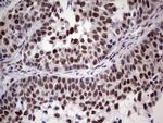 ERCC1 Antibody in Immunohistochemistry (Paraffin) (IHC (P))