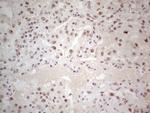 ERCC1 Antibody in Immunohistochemistry (Paraffin) (IHC (P))