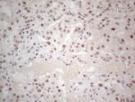 ERCC1 Antibody in Immunohistochemistry (Paraffin) (IHC (P))