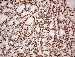 ERCC1 Antibody in Immunohistochemistry (Paraffin) (IHC (P))