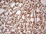 ERCC1 Antibody in Immunohistochemistry (Paraffin) (IHC (P))