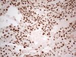 ERCC1 Antibody in Immunohistochemistry (Paraffin) (IHC (P))