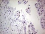 ERCC1 Antibody in Immunohistochemistry (Paraffin) (IHC (P))