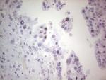 ERCC1 Antibody in Immunohistochemistry (Paraffin) (IHC (P))