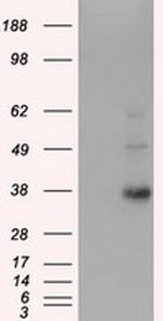 ERCC1 Antibody in Western Blot (WB)