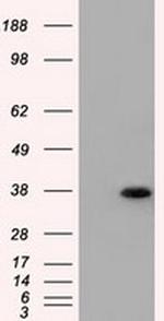 ERCC1 Antibody in Western Blot (WB)