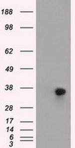 ERCC1 Antibody in Western Blot (WB)