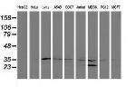 ERCC1 Antibody in Western Blot (WB)