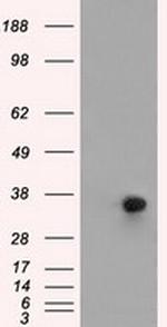 ERCC1 Antibody in Western Blot (WB)
