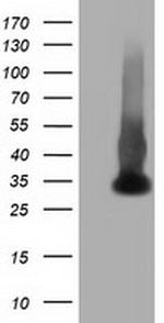 ERCC1 Antibody in Western Blot (WB)