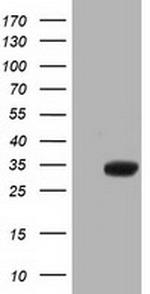 ERCC1 Antibody in Western Blot (WB)