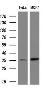 ERCC1 Antibody in Western Blot (WB)