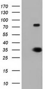 ERCC1 Antibody in Western Blot (WB)