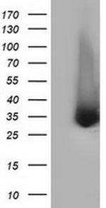 ERCC1 Antibody in Western Blot (WB)
