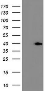 ERCC1 Antibody in Western Blot (WB)