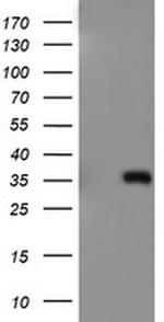 ERCC1 Antibody in Western Blot (WB)