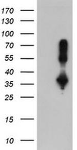 ERCC1 Antibody in Western Blot (WB)