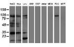 ERCC1 Antibody in Western Blot (WB)