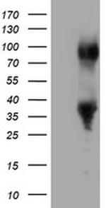 ERCC1 Antibody in Western Blot (WB)