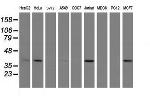 ERCC1 Antibody in Western Blot (WB)