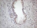 ERCC8 Antibody in Immunohistochemistry (Paraffin) (IHC (P))