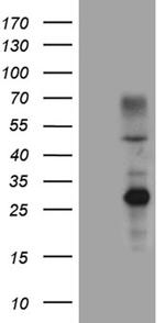 ERCC8 Antibody in Western Blot (WB)