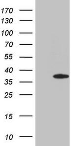 ERCC8 Antibody in Western Blot (WB)