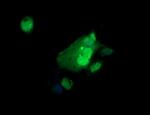 ERG Antibody in Immunocytochemistry (ICC/IF)