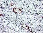 ERG Antibody in Immunohistochemistry (Paraffin) (IHC (P))