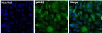 ERK1/ERK2 Monoclonal Antibody (3F8B3)