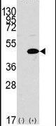 ERK1 Antibody in Western Blot (WB)