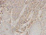 ERK1 Antibody in Immunohistochemistry (IHC)