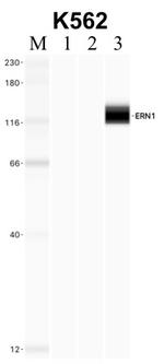 IRE1 alpha Antibody in Immunoprecipitation (IP)