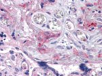 IRE1 alpha Antibody in Immunohistochemistry (Paraffin) (IHC (P))
